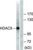 Anti-HDAC9 antibody produced in rabbit affinity isolated antibody