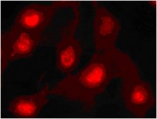 Anti-HMGB1 Antibody, clone HMG1-5H6 clone HMG1-5H6, from hamster