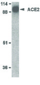 Anti-ACE2 antibody produced in rabbit affinity isolated antibody