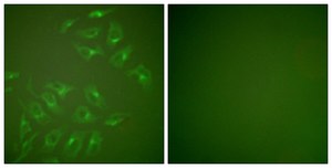 Anti-MMP-13 antibody produced in rabbit affinity isolated antibody
