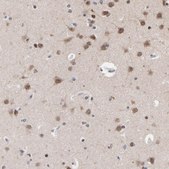 Anti-CHM antibody produced in rabbit Prestige Antibodies&#174; Powered by Atlas Antibodies, affinity isolated antibody, buffered aqueous glycerol solution
