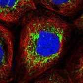 Anti-GLUD1 antibody produced in rabbit Prestige Antibodies&#174; Powered by Atlas Antibodies, affinity isolated antibody, buffered aqueous glycerol solution