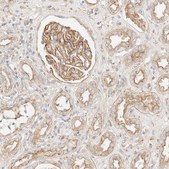 Anti-MYO10 antibody produced in rabbit Prestige Antibodies&#174; Powered by Atlas Antibodies, affinity isolated antibody, buffered aqueous glycerol solution