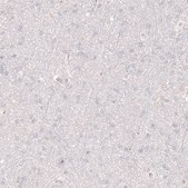 Anti-SLC18A2 antibody produced in mouse Prestige Antibodies&#174; Powered by Atlas Antibodies, clone CL12531, purified by using Protein A, buffered aqueous glycerol solution