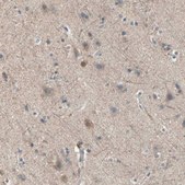 Anti-MPI antibody produced in rabbit Prestige Antibodies&#174; Powered by Atlas Antibodies, affinity isolated antibody, buffered aqueous glycerol solution