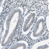 Anti-EVC antibody produced in rabbit Prestige Antibodies&#174; Powered by Atlas Antibodies, affinity isolated antibody, buffered aqueous glycerol solution
