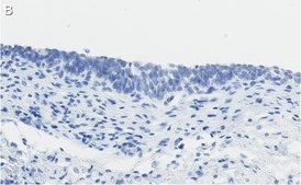 Anti-Bak Antibody, clone 2D18 ZooMAb&#174; Rabbit Monoclonal recombinant, expressed in HEK 293 cells