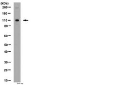 Anti-PHLPP1 Antibody from rabbit, purified by affinity chromatography