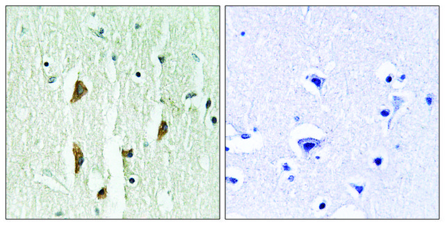 Anti-PAK1 antibody produced in rabbit affinity isolated antibody
