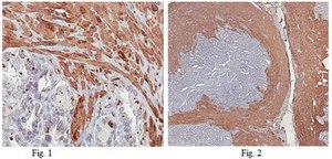 Anti-Calponin-1 Antibody from rabbit, purified by affinity chromatography