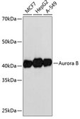 Anti-Aurora B Antibody, clone 3C4V8, Rabbit Monoclonal