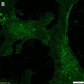 Anti-Neuropilin-1 Antibody, clone 1H21 ZooMAb&#174; Rabbit Monoclonal recombinant, expressed in HEK 293 cells