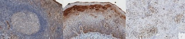 Anti-CtIP Antibody, clone 11-1 clone 11-1, from mouse