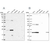 Anti-TFAM antibody produced in rabbit Prestige Antibodies&#174; Powered by Atlas Antibodies, affinity isolated antibody, buffered aqueous glycerol solution