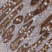 Anti-BDH2 antibody produced in rabbit Prestige Antibodies&#174; Powered by Atlas Antibodies, affinity isolated antibody, buffered aqueous glycerol solution