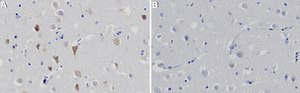 Anti-S1PR2 Antibody, clone 1C18 ZooMAb&#174; Rabbit Monoclonal recombinant, expressed in HEK 293 cells
