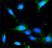 Anti-LAMP2 antibody produced in rabbit affinity isolated antibody, buffered aqueous solution