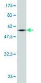 Monoclonal Anti-HOXA9 antibody produced in mouse clone 2A11-2D2, purified immunoglobulin, buffered aqueous solution