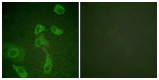 Anti-IL-2R &#946; antibody produced in rabbit affinity isolated antibody