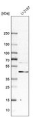 Anti-DLC1 antibody produced in rabbit affinity isolated antibody, buffered aqueous glycerol solution