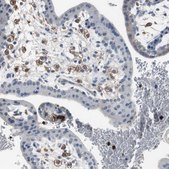 Anti-NCF2 antibody produced in rabbit Prestige Antibodies&#174; Powered by Atlas Antibodies, affinity isolated antibody, buffered aqueous glycerol solution