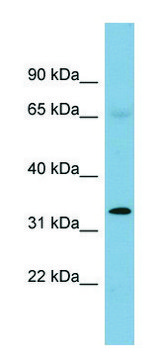 Anti-HEY1 antibody produced in rabbit affinity isolated antibody