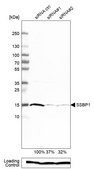 Anti-SSBP1 antibody produced in rabbit Prestige Antibodies&#174; Powered by Atlas Antibodies, affinity isolated antibody, buffered aqueous glycerol solution