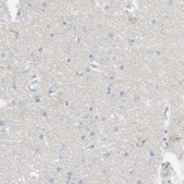 Anti-DUOX1 antibody produced in rabbit Prestige Antibodies&#174; Powered by Atlas Antibodies, affinity isolated antibody, buffered aqueous glycerol solution