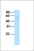 Anti-CAMKK2, (N-terminal) antibody produced in rabbit affinity isolated antibody