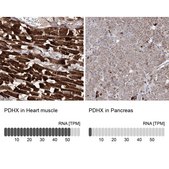 Anti-PDHX antibody produced in rabbit Prestige Antibodies&#174; Powered by Atlas Antibodies, affinity isolated antibody, buffered aqueous glycerol solution