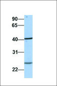 Anti-IDH1 (ab1) antibody produced in rabbit affinity isolated antibody