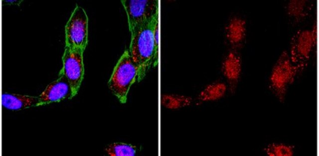 Anti-Bak (NT) Antibody from rabbit, purified by affinity chromatography