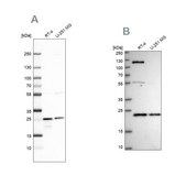 Anti-UQCRFS1 antibody produced in rabbit Prestige Antibodies&#174; Powered by Atlas Antibodies, affinity isolated antibody, buffered aqueous glycerol solution