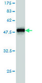 Monoclonal Anti-RHOA antibody produced in mouse clone 1C1, purified immunoglobulin, buffered aqueous solution