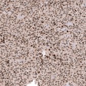 Monoclonal Anti-EZH2 antibody produced in mouse Prestige Antibodies® Powered by Atlas Antibodies, clone CL11945, purified immunoglobulin, buffered aqueous glycerol solution