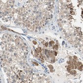 Anti-MPI antibody produced in rabbit Prestige Antibodies&#174; Powered by Atlas Antibodies, affinity isolated antibody, buffered aqueous glycerol solution