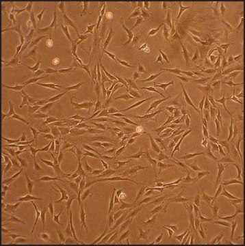 Human Chondrocytes - Osteoarthritis: HC-OA, adult