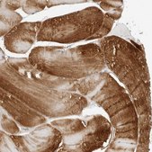 Anti-AMPD1 antibody produced in rabbit Prestige Antibodies&#174; Powered by Atlas Antibodies, affinity isolated antibody, buffered aqueous glycerol solution, ab2