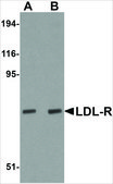 Anti-LDL-R antibody produced in chicken affinity isolated antibody, buffered aqueous solution