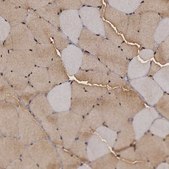 Anti-ENO3 antibody produced in rabbit Prestige Antibodies&#174; Powered by Atlas Antibodies, affinity isolated antibody, buffered aqueous glycerol solution