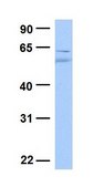 Anti-FOXO3 antibody produced in rabbit affinity isolated antibody