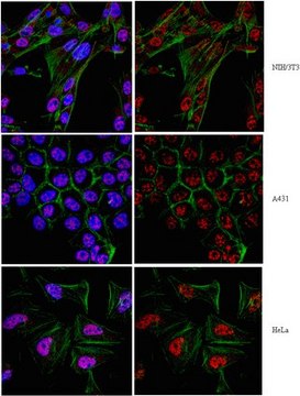 Anti-Twist1 (Twist-related protein 1) Antibody from rabbit, purified by affinity chromatography