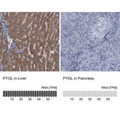 Anti-PYGL antibody produced in rabbit Prestige Antibodies&#174; Powered by Atlas Antibodies, affinity isolated antibody, buffered aqueous glycerol solution