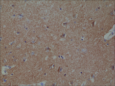 Anti-Spastin antibody, Rabbit monoclonal recombinant, expressed in HEK 293 cells, clone RM346, purified immunoglobulin
