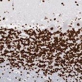 Anti-MECP2 antibody produced in rabbit Ab2, Prestige Antibodies® Powered by Atlas Antibodies, affinity isolated antibody, buffered aqueous glycerol solution