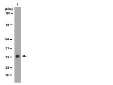 Anti-HDAC11 Antibody from rabbit, purified by affinity chromatography
