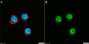 Anti-Bcl-11B Antibody, clone 1G14 ZooMAb&#174; Rabbit Monoclonal recombinant, expressed in HEK 293 cells