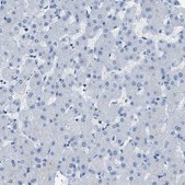 Anti-ITPR1 antibody produced in rabbit Prestige Antibodies&#174; Powered by Atlas Antibodies, affinity isolated antibody, buffered aqueous glycerol solution