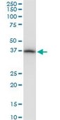 Monoclonal Anti-PRSS8 antibody produced in mouse clone 3C4, ascites fluid