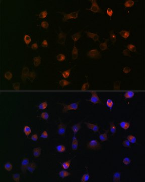 Anti-&#947;-Catenin Antibody, clone 9O2K8, Rabbit Monoclonal
